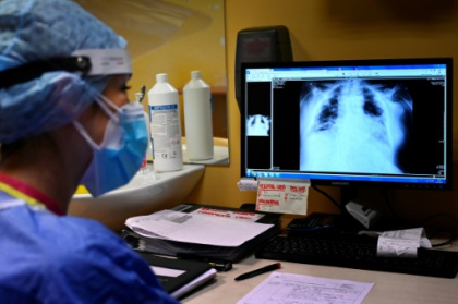 TB cases rise after years of decline.jpg