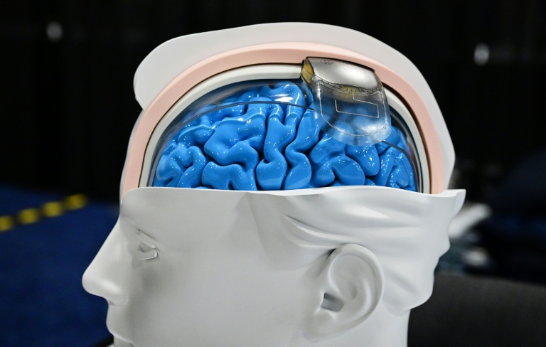 'We're already living in science fiction': The neurotech revolution